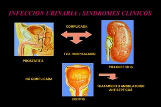 PROSTATITIS
PIELONEFRITIS
CISTITIS
COMPLICADA
TTO. HOSPITALARIO
TRATAMIENTO AMBULATORIO
ANTISEPTICOS
INFECCION URINARIA : SINDROMES CLINICOS
NO COMPLICADA
 
