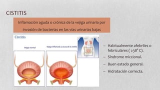 CISTITIS
Inflamación aguda o crónica de la vejiga urinaria por
invasión de bacterias en las vías urinarias bajas

Habitualmente afebriles o
febriculares ( ≥38° C).
Síndrome miccional.

Buen estado general.
Hidratación correcta.

 