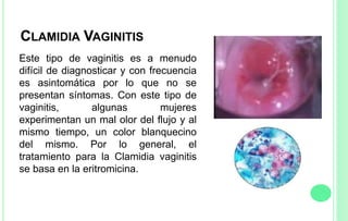 CLAMIDIA VAGINITIS
Este tipo de vaginitis es a menudo
difícil de diagnosticar y con frecuencia
es asintomática por lo que no se
presentan síntomas. Con este tipo de
vaginitis, algunas mujeres
experimentan un mal olor del flujo y al
mismo tiempo, un color blanquecino
del mismo. Por lo general, el
tratamiento para la Clamidia vaginitis
se basa en la eritromicina.
 