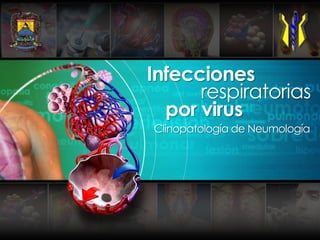 Infecciones
      respiratorias
  por virus
Clinopatología de Neumología
 