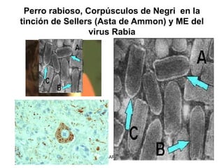 Perro rabioso, Corpúsculos de Negri en la
tinción de Sellers (Asta de Ammon) y ME del
                 virus Rabia




             FUNDACION BARCELO FACULTAD DE MEDICINA
 