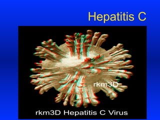 Hepatitis C
 