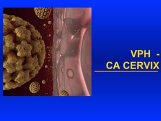 VPH -
CA CERVIX
 