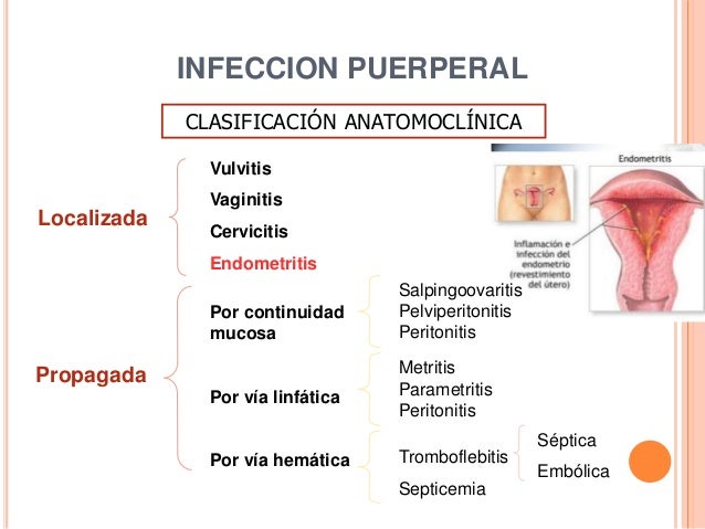 Puerperio Patologico Epub