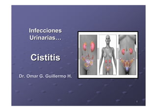 11
InfeccionesInfecciones
UrinariasUrinarias……
CistitisCistitis
Dr. Omar G. Guillermo H.Dr. Omar G. Guillermo H.
 