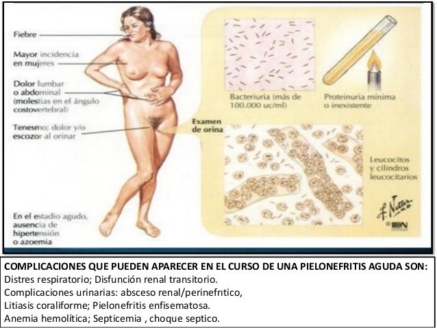 La hernia intervertebral del departamento lumbar el tratamiento odessa