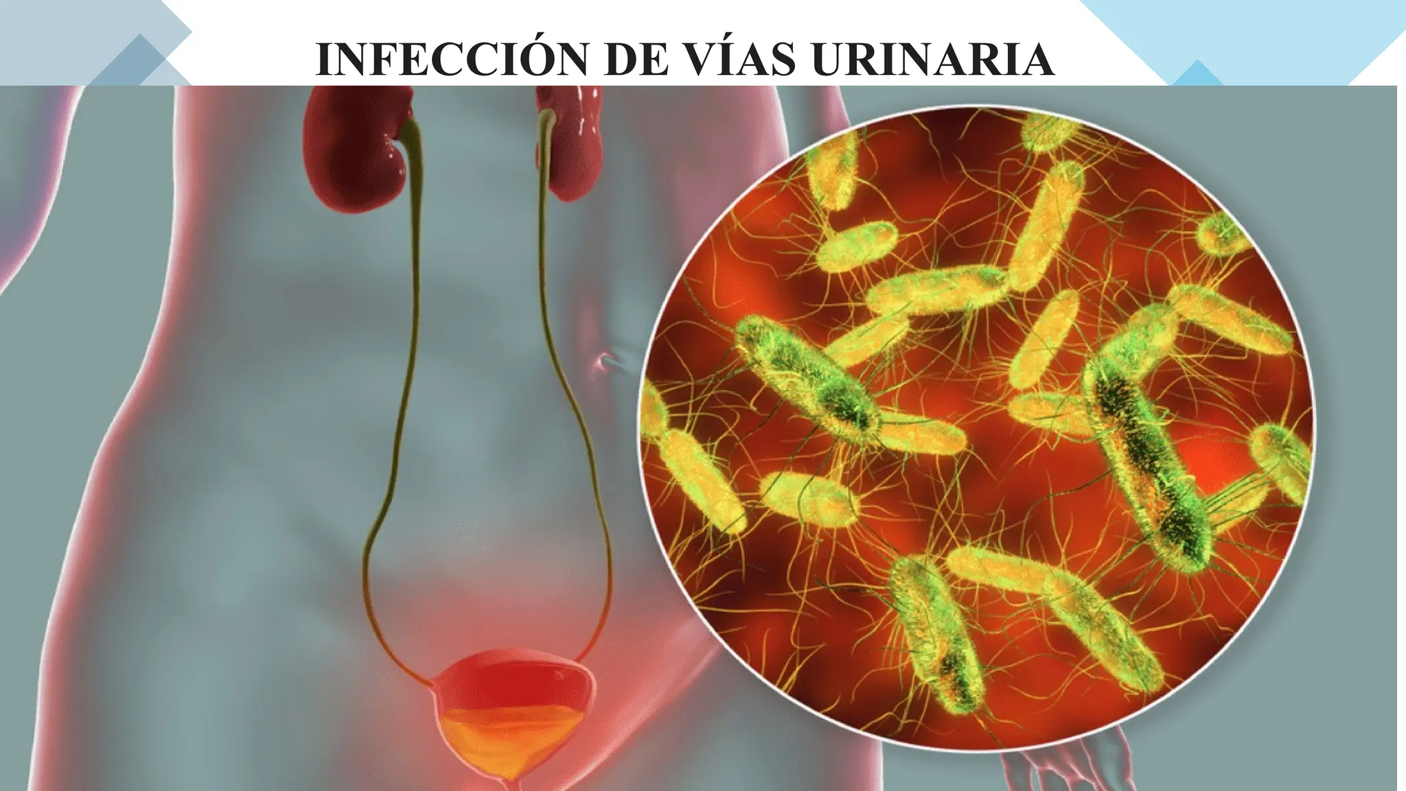 Sumake Infeccion INFECCÍON DE VÍAS URINARIAS EN MEDICINA FAMILIAR Y COMUNITARIA | PPTX