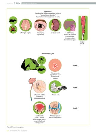62 ] INFECCIONES POR BACTERIAS [
Manual A Mir www.academiamir.com
Figura 25. Resumen espiroquetas.
Leptospirosis
Espiroqueta de metabolismo aerobio (la única)
"Meningitis con ojos rojos"
Transmisión por contacto directo, sin vector
Meningitis aséptica Hemorragias
conjuntivales
Afectación renal ↑ de bilirrubina,
enzimas de colestasis
y transaminasas
Formas severa con
diatesis hemorrágicas
Mialgias
de CPK
Enfermedad de Lyme
Eritema crónico
migratorio en lugar
de inoculación
Indoloro
Bloqueo A-VAfectación de SNC
y periférico
Típico parálisis facial
Acrodermatitis
crónica atrófica
Linfocitoma en oreja y
mama (linfoadenosis
benigna cutis)
Artritis de grandes
articulaciones (rodilla)
Estadio 1
Estadio 2
Estadio 3
 