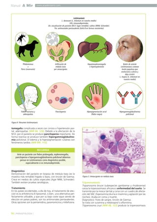 Manual A Mir
96 ] PARASITOLOGÍA [
www.academiamir.com
tomegalia complicada a veces con cirrosis e hipertensión por-
tal, adenopatías (MIR 06, 126). Debido a la afectación de la
M.O. por el parásito se produce pancitopenia importante. De
forma reactiva se produce también hipergammaglobuline-
mia policlonal. El edema y la hiperpigmentación cutánea son
fenómenos tardíos (MIR 99F, 112).
Diagnóstico
Demostración del parásito en biopsia de médula ósea (es la
muestra más rentable) hígado o bazo, con tinción de Giemsa.
Crece en medios de cultivo especiales (Agar NNN, Schneider).
También existen pruebas serológicas.
Tratamiento
En los países occidentales, a día de hoy, el tratamiento de elec-
ción es la anfotericina B liposomal, si bien, una alternativa per-
fectamente utilizable, y que por su bajo coste sigue siendo de
elección en países pobres, son los antimoniales pentavalentes.
Otras opciones son la pentamidina, paramomicina y miltefosina.
Tripanosomiasis
Trypanosoma brucei (subespecies gambiense y rhodesiense)
causa la tripanosomiasis africana o enfermedad del sueño. Se
transmite por la mosca tsé-tsé y cursa con un cuadro de afecta-
ción del SNC (hipersomnia diurna e insomnio y agitación por las
noches). Acaba en coma y muerte.
Diagnostico: frotis de sangre, tinción de Giemsa.
Se trata con suramina y melarsoprol o eflornitina.
Trypanosoma cruzi (MIR 08, 123) produce la tripanosomiasis
Figura 4. Resumen leishmaniasis.
Leishmaniasis
L. donovani (L. infantum en nuestro medio)
VIH, inmunodeprimidos
Dx: visualización de parásito (M.O. lugar rentable), cultivo (NNN, Schneider).
Tto: antimoniales pentavalente (Anfo B en formas resistentes)
Phlebotomus
+
Perro (reservorio)
Hiperpigmentación acral
(fiebre negra)
Hipergammaglobulinemia
policlonal
Infiltración de
médula ósea
por amascigotes
Hepatoesplenomegalia
e hiperesplenismo
Botón de oriente
Leishmaniasis cutánea
lesión papulosa que
evoluciona a úlcera y
deja cicatriz
L. tropica (L. infantum en
nuestro medio)
PancitopeniaFiebre nocturna y
adenopatías
Ante un paciente con fiebre prolongada, esplenomegalia,
pancitopenia e hipergammaglobulinemia policlonal debemos
pensar en Leishmaniasis como diagnóstico posible,
especialmente si es inmunodeprimido.
RECUERDA
Figura 3. Amascigotes en médula ósea.
 