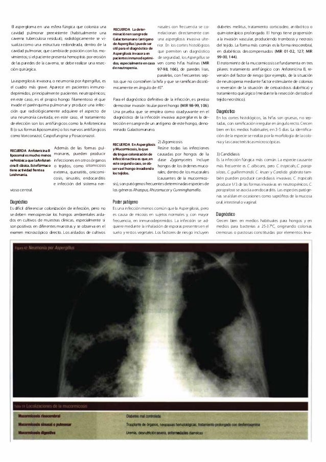 nia 260 diabetes diapositivas
