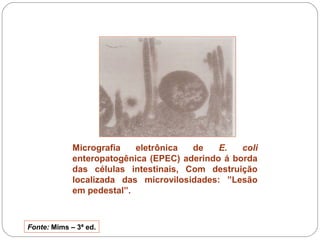 Micrografia eletrônica de E. coli 
enteropatogênica (EPEC) aderindo á borda 
das células intestinais, Com destruição 
localizada das microvilosidades: ”Lesão 
em pedestal”. 
Fonte: Mims – 3ª ed. 
 