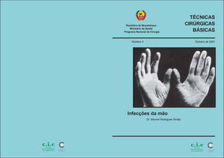 República de Moçambique
Ministério da Saúde
Programa Nacional de Cirurgia
TÉCNICAS
CIRÚRGICAS
BÁSICAS
Infecções da mão
Dr. Manuel Rodrigues Simão
Número 3 Outubro de 2001
 