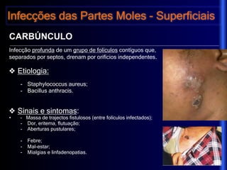 Lobulo Infectado Infecções de Tecidos Moles.pdf