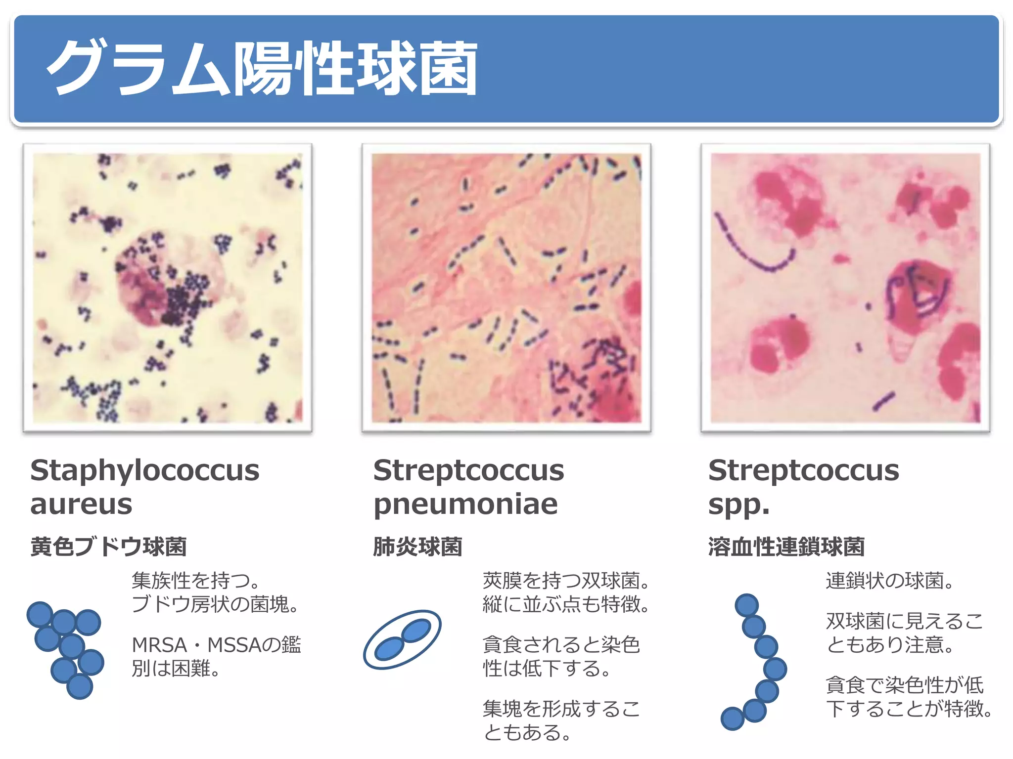 グラム陽性球菌
黄色ブドウ球菌
Staphylococcus
aureus
肺炎球菌
Streptcoccus
pneumoniae
溶血性連鎖球菌
Streptcoccus
spp.
集族性を持つ。
ブドウ房状の菌塊。
MRSA・MSSAの鑑
別は困難。
莢膜を持つ双球菌。
縦に並ぶ点も特徴。
貪食されると染色
性は低下する。
集塊を形成するこ
ともある。
連鎖状の球菌。
双球菌に見えるこ
ともあり注意。
貪食で染色性が低
下することが特徴。
 
