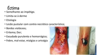 Éctima
• Semelhante ao impétigo.
• Limita-se à derme
• Etiologia
• Lesão pustular com centro necrótico característico;
• Bordos violáceos;
• Eritema; Dor;
• Exsudado purulento e hemorrágico;
• Febre, mal-estar, mialgias e artralgia
 