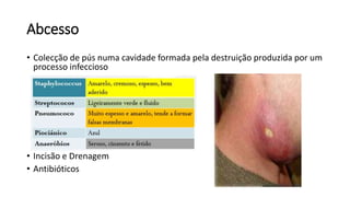 Abcesso
• Colecção de pús numa cavidade formada pela destruição produzida por um
processo infeccioso
• Incisão e Drenagem
• Antibióticos
 