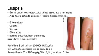 Erisipela
• É uma celulite estreptococica difusa associada a linfangite
• A porta de entrada pode ser: Picada; Corte; Arranhão
• Eritematosa;
• Quente;
• Sensível;
• Edematosa.
• bordos elevados, bem definidos,
irregulares e avermelhados
Penicilina G cristalina - 100.000 UI/Kg/dia
e.v. 6/6h, até melhoria clínica seguido de
Amoxicilina – 50 a 100 mg/kg/dia - 8/8h, total de 10 dias
 
