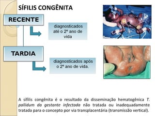 A sífilis congênita é o resultado da disseminação hematogênica T.
pallidum da gestante infectada não tratada ou inadequadamente
tratada para o concepto por via transplacentária (transmissão vertical).
SÍFILIS CONGÊNITA
 