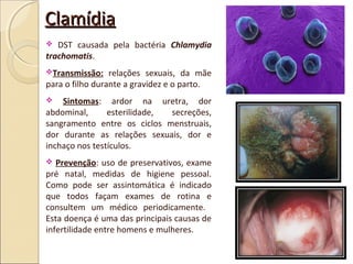 ClamídiaClamídia
 DST causada pela bactéria Chlamydia
trachomatis.
Transmissão: relações sexuais, da mãe
para o filho durante a gravidez e o parto.
 Sintomas: ardor na uretra, dor
abdominal, esterilidade, secreções,
sangramento entre os ciclos menstruais,
dor durante as relações sexuais, dor e
inchaço nos testículos.
 Prevenção: uso de preservativos, exame
pré natal, medidas de higiene pessoal.
Como pode ser assintomática é indicado
que todos façam exames de rotina e
consultem um médico periodicamente.
Esta doença é uma das principais causas de
infertilidade entre homens e mulheres.
 