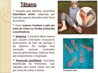 TétanoTétano
 Causada pela bactéria anaeróbica
Clostridium tetani, adquirida por
meio de esporos liberados pelas fezes
de animais.
 Esses esporos invadem a pele por
meio de cortes ou feridas profundas
e queimaduras.
 Sintomas: a bactéria libera toxinas
que causam contrações musculares
involuntárias da face, do pescoço e
do abdome. Em estágio mais
avançado, ocorrem contrações
intensas generalizadas. Pode ser fatal,
por comprometer a respiração.
 Prevenção (profilaxia): vacinação,
desinfecção de ferimentos, usar
calçados para evitar cortes nos pés
por cacos de vidros e metais.
 