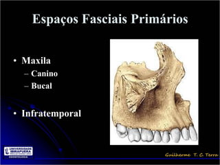 Espaços Fasciais Primários


• Maxila
  – Canino
  – Bucal


• Infratemporal
 