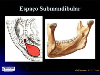 Espaço Submandibular
 