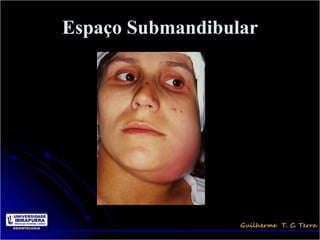 Espaço Submandibular
 