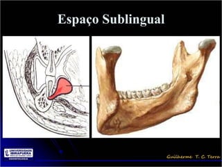 Espaço Sublingual
 