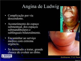 Angina de Ludwig
• Complicação por via
  descendente.
• Acometimento do espaço
  submentual, dos espaços
  submandibulares e
  sublinguais bilateralmente.
• Encaminhar ao serviço
  médico com extrema
  urgência.
• Se demorado a tratar, grande
  chance de evoluir ao óbito.

                                        .
                                 Terra, G
 