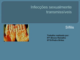 Infecções sexualmente transmissíveis Sífilis Trabalho realizado por:  Nº1-Bruno Ramalho Nº18-Pedro Brites 