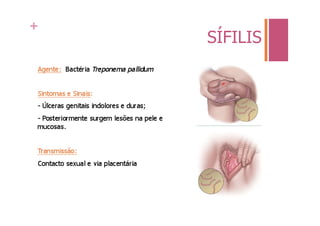 +
    SÍFILIS
 