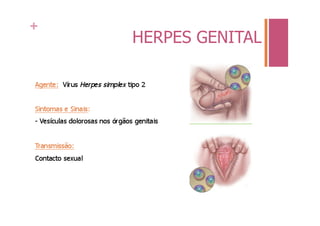 +
    HERPES GENITAL
 