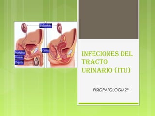 INFECIONES DEL
TRACTO
URINARIO (ITU)
FISIOPATOLOGIA2°
 