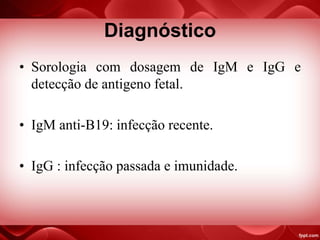 Diagnóstico
• Sorologia com dosagem de IgM e IgG e
detecção de antigeno fetal.
• IgM anti-B19: infecção recente.
• IgG : infecção passada e imunidade.
 
