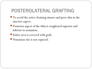 POSTEROLATERAL GRAFTING
To avoid the active draining sinuses and poor skin in the
anterior aspect.
Posterior aspect of the tibia is roughened superior and
inferior to nonunion.
Entire area is covered with graft.
Nonunion site is not exposed.
 