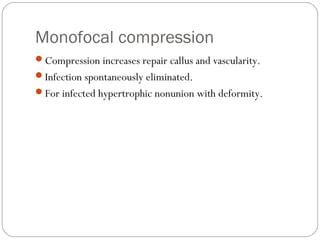 Monofocal compression
Compression increases repair callus and vascularity.
Infection spontaneously eliminated.
For infected hypertrophic nonunion with deformity.
 