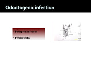 • Periapical infection
• Pericoronitis

 