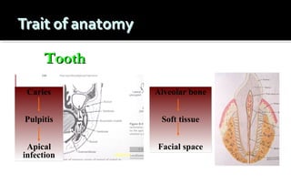 Tooth
Caries

Alveolar bone

Pulpitis

Soft tissue

Apical
infection

Facial space

 
