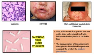 Sss Rash INFECTIONS COMMON BACTERIAL VIRAL AND PARASITIC INFECTIONS-UG FINAL.pptx