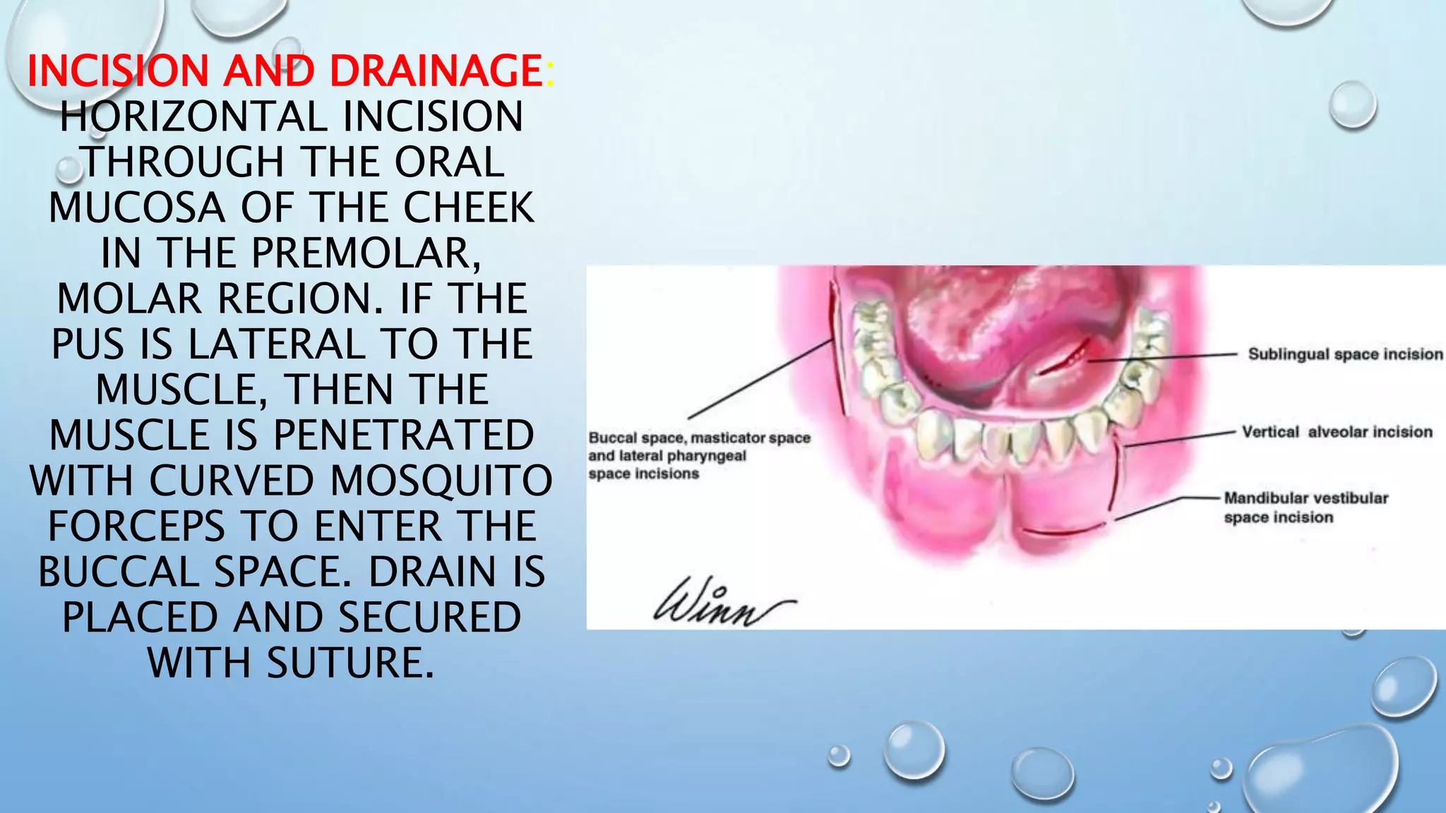 Draining Incision Infection 2 | PPTX