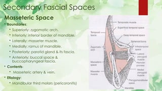 Submasseter Space Infection and Facial spaces of oral cavity | PPTX