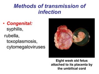 Methods of transmission of
infection
• Congenital:
syphilis,
rubella,
toxoplasmosis,
cytomegaloviruses
Eight week old fetu...