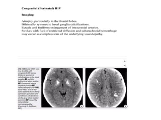 Comprehensive Overview of CNS Brain Lesions and Tumor Characteristics ...