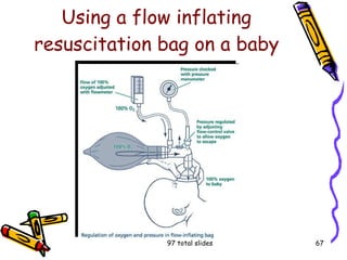 Flow Inflating Bagh Infection Control | PPT