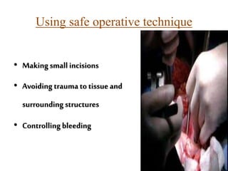 Using safe operative technique
• Makingsmallincisions
• Avoiding traumato tissue and
surrounding structures
• Controllingbleeding
55
 