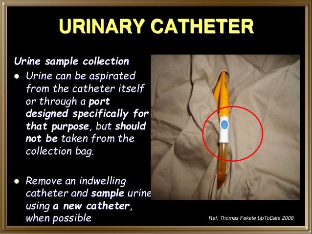 urine catheter urinary uti