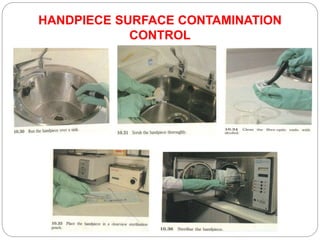 HANDPIECE SURFACE CONTAMINATION
CONTROL
 
