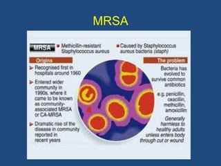 MRSA
 