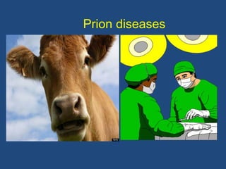 Prion diseases
 
