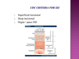1. Superficial incisional
2. Deep incisional
3. Organ / space SSI
 